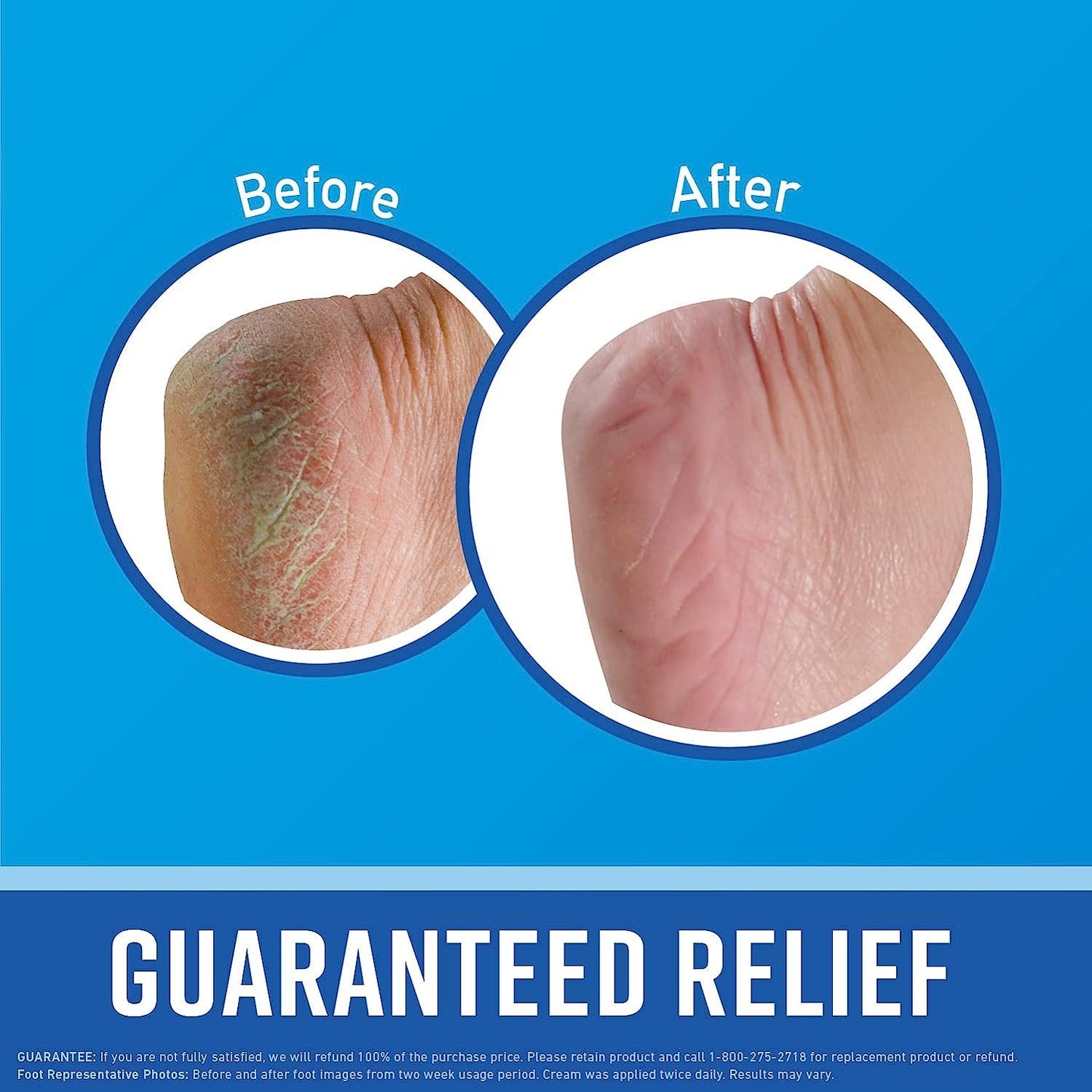 O'Keeffe's for Healthy Feet Foot Cream Guaranteed Relief Extremely Dry Cracked Clinically Proven to Instantly Boost Moisture Levels 3.0 Ounce Tube Pack of